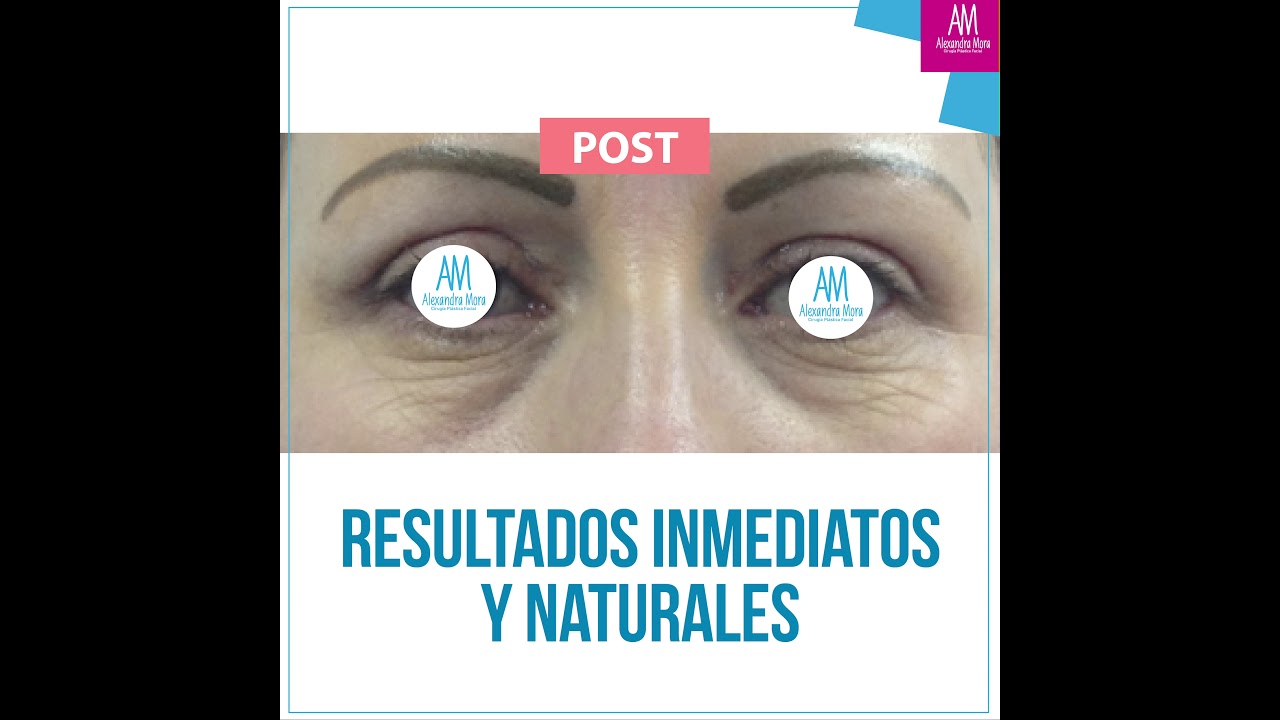 Alexandra Mora Hernandez-160