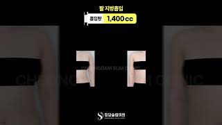 왜 다들 팔라인을 중요하게 생각하는지 알겠음👀