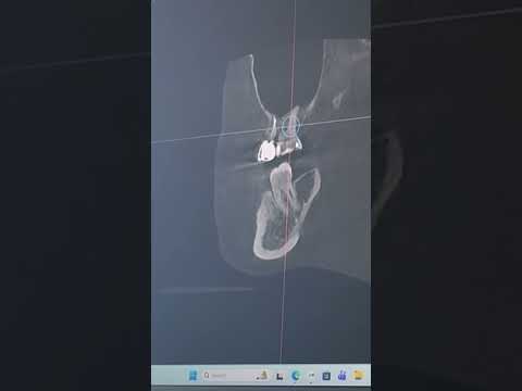 CBCT Cone Beam Imaging