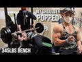 MY SHOULDER POPPED WHILE BENCHING! **HAD TO GO TO THE HOSPITAL