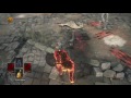 Dark Hand Is This Nigga Serious