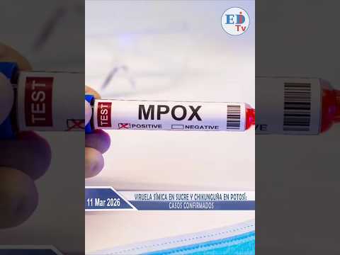 Viruela símica en Sucre y chikunguña en Potosí: casos confirmados