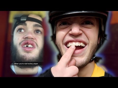 HOCKEY PUCK TO THE FACE! *clickbait*