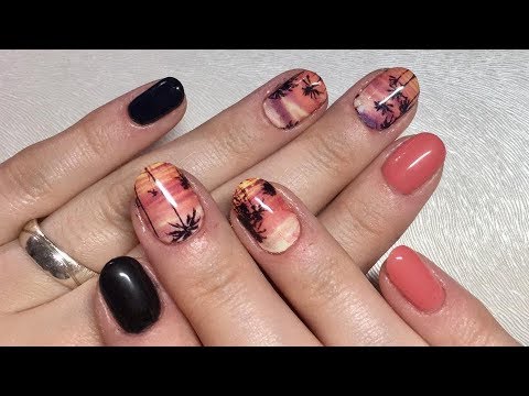 Der Candiden bei gribke zwischen den Fingern der Beine Wie den Nagelzwang auf dem Daumen des Beines des Fotos zu heilen