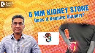 KIDNEY STONE Treatment for 4mm, 5mm, 6 mm | #kidneystone Treatment ESWL, RIRS - Dr. Girish Nelivigi