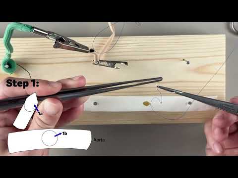 End-to-Side Vascular Anastomosis (proximal CABG)