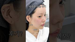 리쥬란으로 촉촉속광피부 만들기 💯