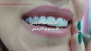 جديد وحصري ، فكين معًا ، لون أبيض الطبيعي
