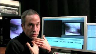 Vocal Cord Stripping