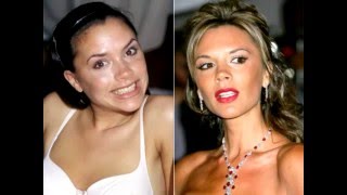 РЕСТАВРАЦИЯ ЗУБОВ ЗВЕЗД ТОП 5