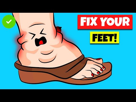, title : '🟢 Fix Your Swollen Feet Fast With These Home Remedies For Swollen Feet'
