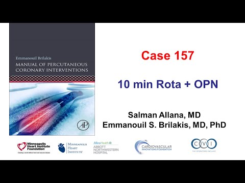 Case 157: Manual of PCI: 10 min Rota + OPN