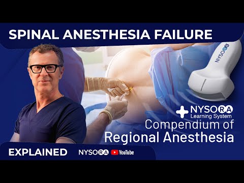 SPINAL ANESTHESIA FAILURE - Crash course with Dr. Hadzic