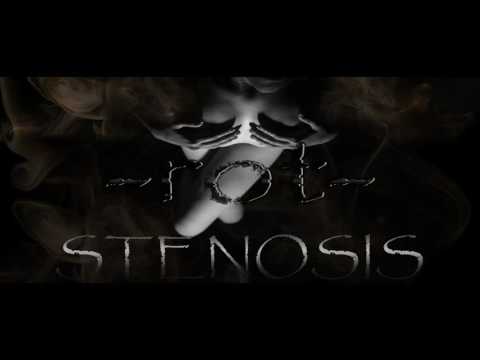 Stenosis 