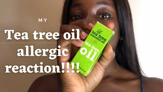 I Had An Allergic Reaction | Tea Tree Oil, Neutrogena?