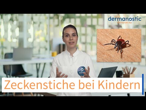 Ärztin erklärt: Zeckenbisse - Zeckenstiche; Worauf achtet man bei Kindern? dermanostic