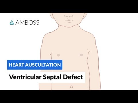 Ventricular Septal Defect (VSD) - Heart Auscultation - Episode 11