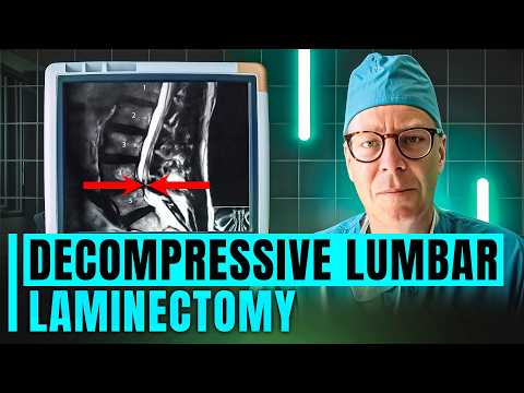 Decompressive Lumbar Laminectomy Procedure | What to Expect