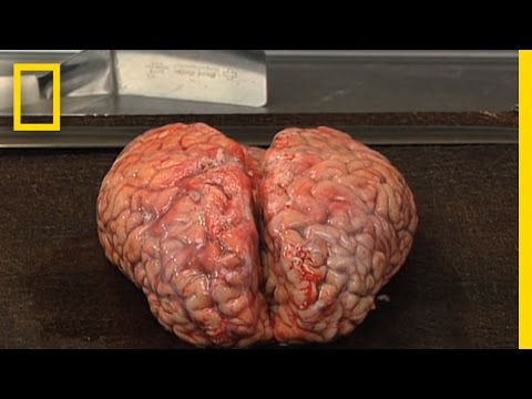 Brain banks and their importance - part I - video series