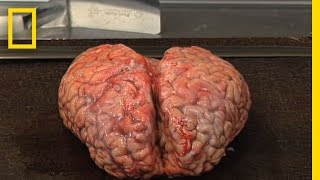 Brain Bank | National Geographic