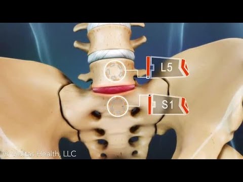 Gelenkschmerzen um die Ferse Joint wächst