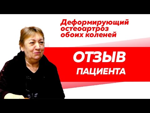 Отзыв Rekinetix. Лечение деформирующегося остеоартроза обоих коленей