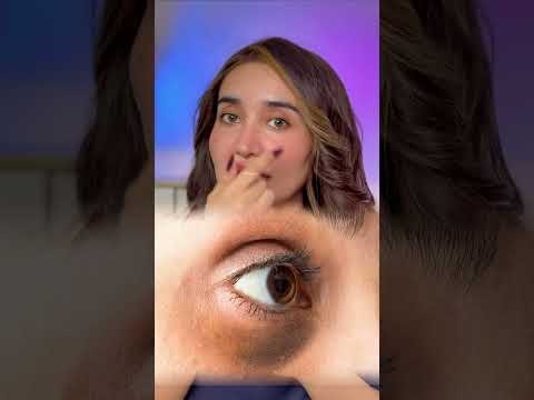 Types of dark circles! #pakistani #skincare #shorts