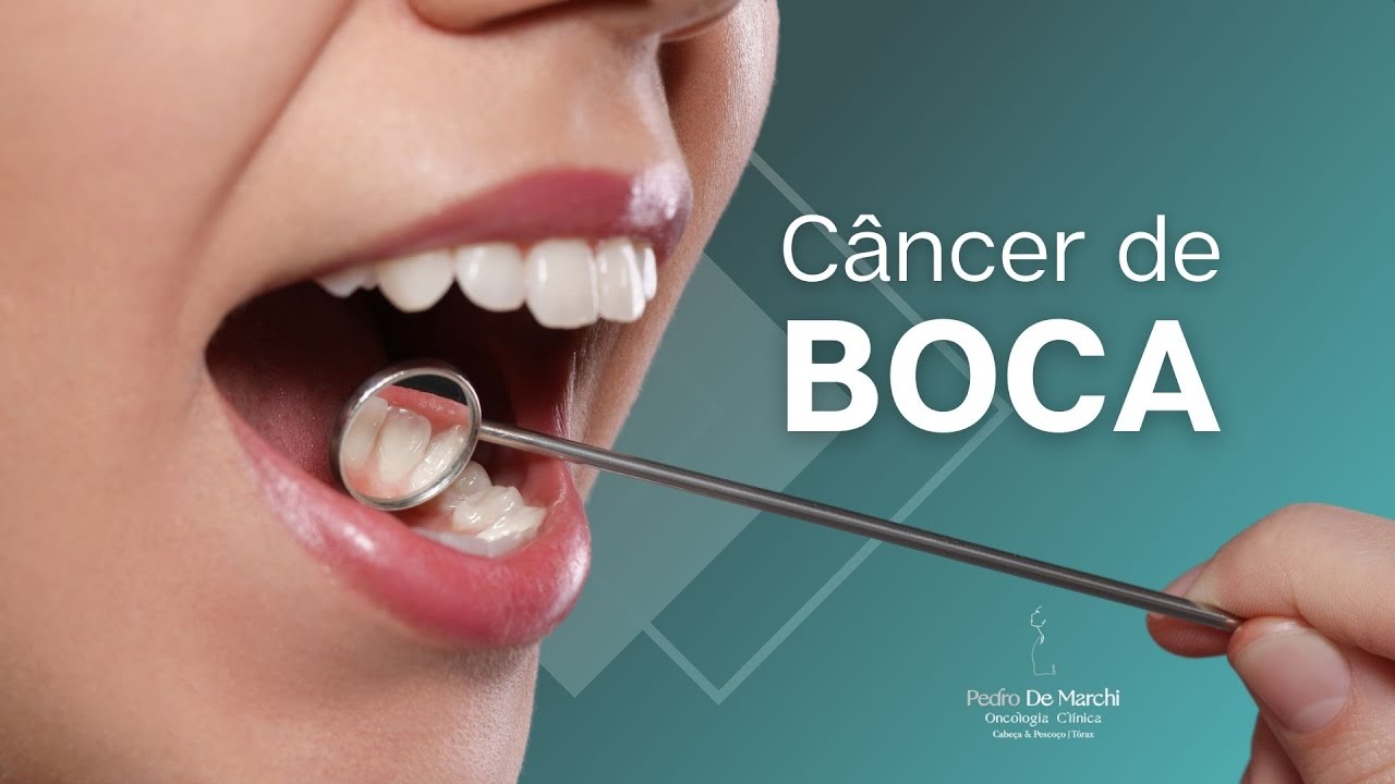 Câncer de boca - conheça tudo sobre essa doença