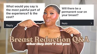 BREAST REDUCTION Q&A | What they DON’T tell you!