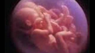 YO TE ESPERABA, ALEJANDRA GUZMÁN.wmv