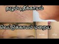 How To Remove Acne Scars Marks Home Remedies தழும்பு வெட்டுக்காய