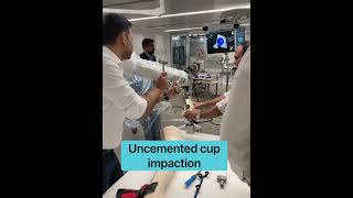 Download lagu Robotic hip replacement on bone model #hipreplacementsurgery #robotics mp3 Download lagu Robotic hip replacement on bone model #hipreplacementsurgery #robotics mp3