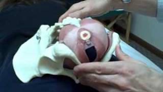 Trigger point assessment and treatment for Pelvic Floor triggers M 3 Seminar