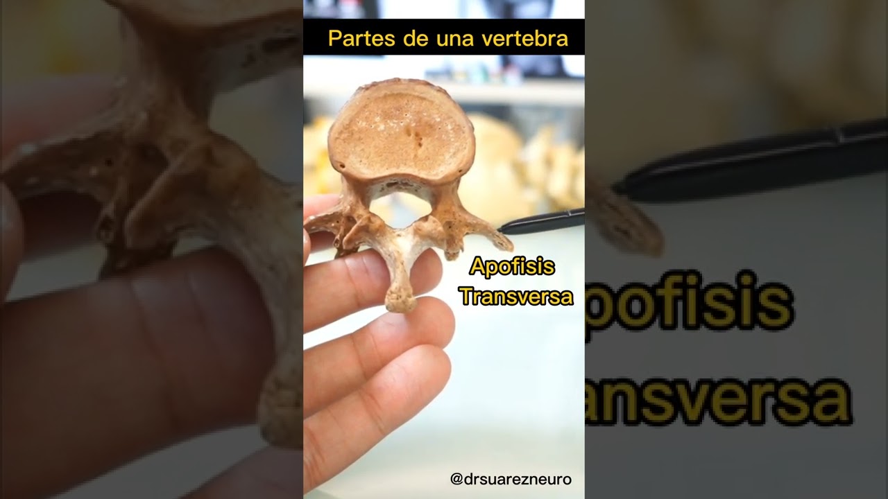 parts of a real lumbar vertebra anatomy
