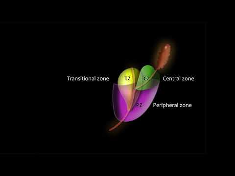 Prostatitisrel a prostatitis