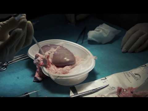 Impressie Video - Organ Assist (2017)