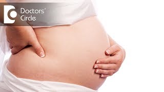 Pregnancy with IUCD - Dr. Sangeeta Gomes