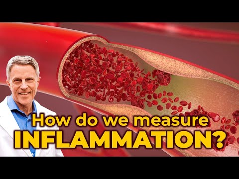 How do we measure inflammation?