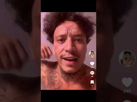 Vium explains he’s getting tattoo removed (cries)😢🤦‍♂️🤝#trending #tiktok #cries #wow #vium #fun