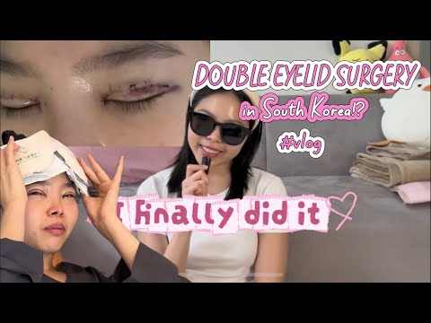I Had Double Eyelid Surgery in South Korea!😱 Not as scary as I thought 🤔 @Dr.Yoo-Facetalk @Medipact 