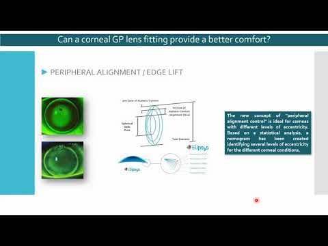 The reason why we should keep trusting corneal Gas Perm lenses