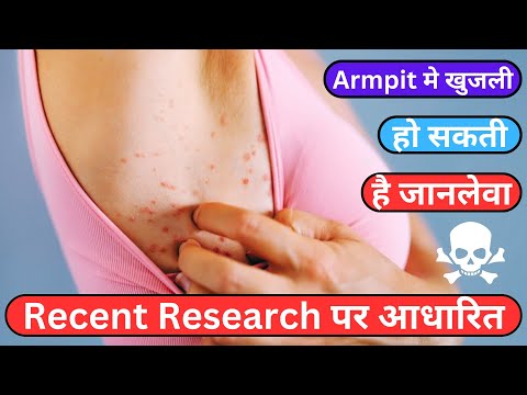 ये 5 बीमारी हो सकते है Armpit मे खुजली के कारण #armpits #armpitmekhujli #healthtips #sehat #healthy