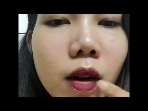 โรคสะเก็ดเงิน sintomitsina ร้องไห้กลากและ SDA