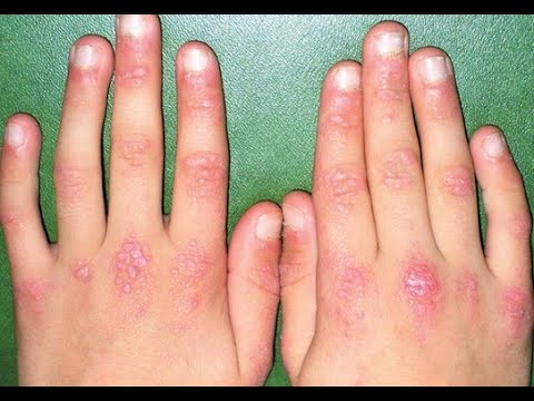 ストラスブルゲリア科 - 定義