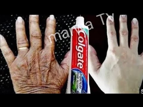 يديك تبدو مثل العجوز بملعقه معجون اسنان تخلصي من اسمرار وتششققات الايدي نهائيا