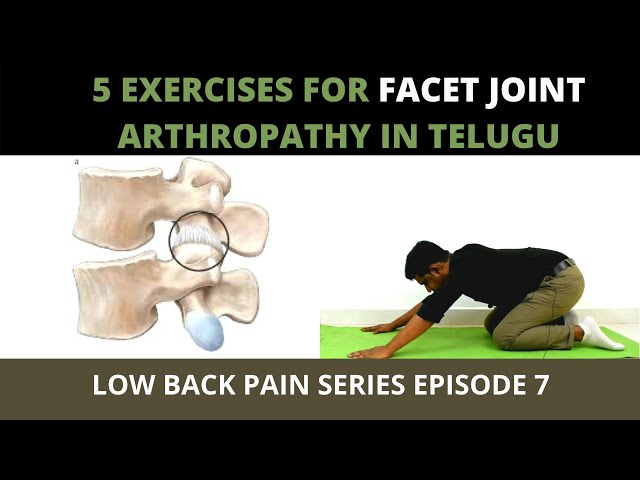 Video Uitspraak van arthropathy in Engels