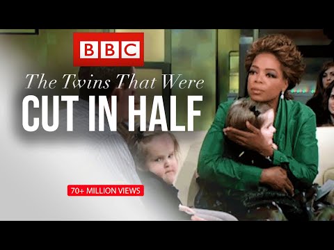 Miracle Twins: The Untold Story | BBC Documentary by Sohrab Mirmont