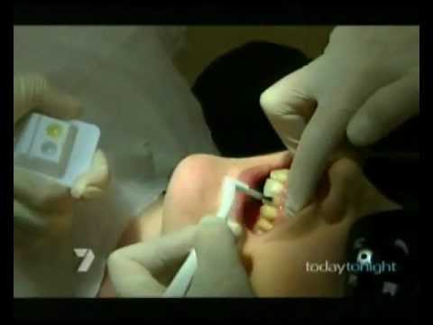 GlamSmile on Today Tonight