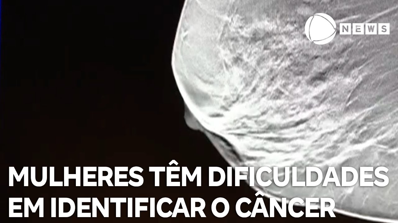 Mulheres têm dificuldades em identificar o câncer de mama