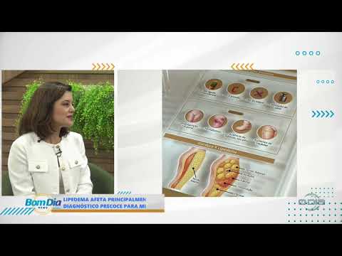 O Dia TV